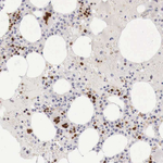 GATA1 Antibody in Immunohistochemistry (Paraffin) (IHC (P))