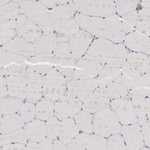 GATA1 Antibody in Immunohistochemistry (Paraffin) (IHC (P))