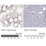 GATA1 Antibody in Immunohistochemistry (Paraffin) (IHC (P))