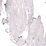 JunB Antibody in Immunohistochemistry (Paraffin) (IHC (P))