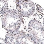 JunB Antibody in Immunohistochemistry (Paraffin) (IHC (P))