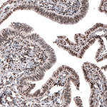 JunB Antibody in Immunohistochemistry (Paraffin) (IHC (P))