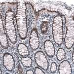 JunB Antibody in Immunohistochemistry (Paraffin) (IHC (P))