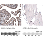 JunB Antibody in Immunohistochemistry (Paraffin) (IHC (P))