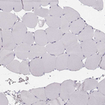 Calcium Sensing Receptor Antibody in Immunohistochemistry (Paraffin) (IHC (P))