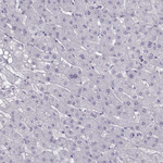 Calcium Sensing Receptor Antibody in Immunohistochemistry (Paraffin) (IHC (P))
