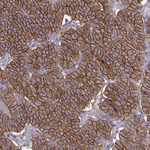 Calcium Sensing Receptor Antibody in Immunohistochemistry (Paraffin) (IHC (P))
