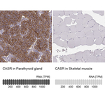 Calcium Sensing Receptor Antibody in Immunohistochemistry (Paraffin) (IHC (P))