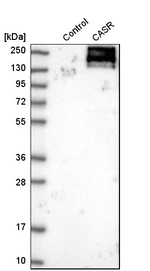 Calcium Sensing Receptor Antibody in Western Blot (WB)