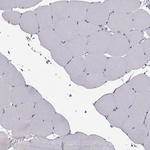 Calcium Sensing Receptor Antibody in Immunohistochemistry (Paraffin) (IHC (P))