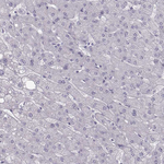 Calcium Sensing Receptor Antibody in Immunohistochemistry (Paraffin) (IHC (P))