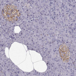 Calcium Sensing Receptor Antibody in Immunohistochemistry (Paraffin) (IHC (P))