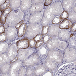 Calcium Sensing Receptor Antibody in Immunohistochemistry (Paraffin) (IHC (P))