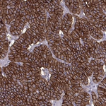 Calcium Sensing Receptor Antibody in Immunohistochemistry (Paraffin) (IHC (P))