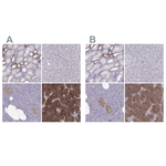Calcium Sensing Receptor Polyclonal Antibody
