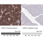 Calcium Sensing Receptor Antibody in Immunohistochemistry (Paraffin) (IHC (P))
