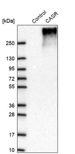 Calcium Sensing Receptor Antibody in Western Blot (WB)