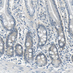 FKBP4 Antibody in Immunohistochemistry (Paraffin) (IHC (P))