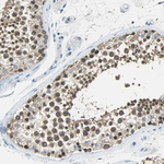 FKBP4 Antibody in Immunohistochemistry (Paraffin) (IHC (P))