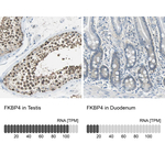 FKBP4 Antibody in Immunohistochemistry (Paraffin) (IHC (P))