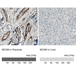 CD146 Antibody in Immunohistochemistry (Paraffin) (IHC (P))