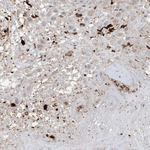 Osteopontin Antibody in Immunohistochemistry (Paraffin) (IHC (P))