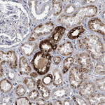 Osteopontin Antibody in Immunohistochemistry (Paraffin) (IHC (P))