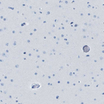 GPR18 Antibody in Immunohistochemistry (Paraffin) (IHC (P))