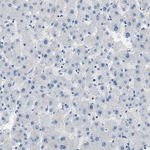 Claudin 18 Antibody in Immunohistochemistry (Paraffin) (IHC (P))