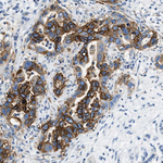 Claudin 18 Antibody in Immunohistochemistry (Paraffin) (IHC (P))