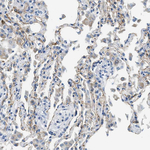 Claudin 18 Antibody in Immunohistochemistry (Paraffin) (IHC (P))
