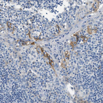 Claudin 18 Antibody in Immunohistochemistry (Paraffin) (IHC (P))