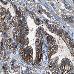 Claudin 18 Antibody in Immunohistochemistry (Paraffin) (IHC (P))