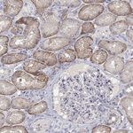 PTH1R Antibody in Immunohistochemistry (Paraffin) (IHC (P))