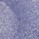 PTH1R Antibody in Immunohistochemistry (Paraffin) (IHC (P))
