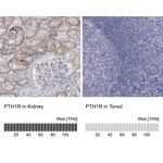 PTH1R Polyclonal Antibody