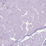 HTR2B Antibody in Immunohistochemistry (Paraffin) (IHC (P))