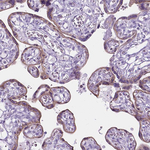 HTR2B Antibody in Immunohistochemistry (Paraffin) (IHC (P))