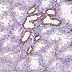 HTR2B Antibody in Immunohistochemistry (Paraffin) (IHC (P))