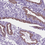 HTR2B Antibody in Immunohistochemistry (Paraffin) (IHC (P))