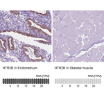HTR2B Polyclonal Antibody