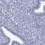P2Y6 Antibody in Immunohistochemistry (Paraffin) (IHC (P))