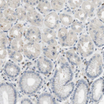 P2Y1 Antibody in Immunohistochemistry (Paraffin) (IHC (P))