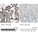 P2Y1 Polyclonal Antibody