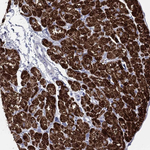 CPT1B Antibody in Immunohistochemistry (Paraffin) (IHC (P))