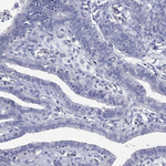 CPT1B Antibody in Immunohistochemistry (Paraffin) (IHC (P))