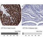 CPT1B Antibody in Immunohistochemistry (Paraffin) (IHC (P))