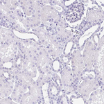 GPR17 Antibody in Immunohistochemistry (Paraffin) (IHC (P))