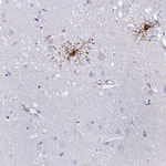 GPR17 Antibody in Immunohistochemistry (Paraffin) (IHC (P))
