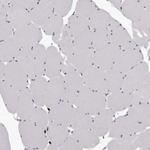 AHR Antibody in Immunohistochemistry (Paraffin) (IHC (P))